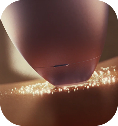 IPL SenseIQ Technology